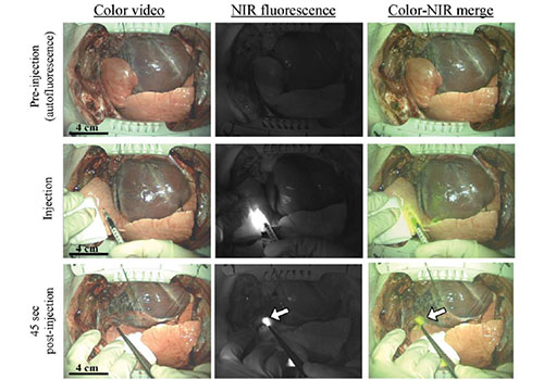 Intraoperative Sentinel Lymph Node Mapping of the Lung Using Near-Infrared Fluorescent Quantum Dots