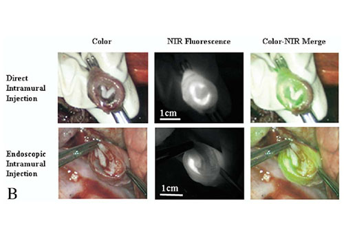 Intraoperative identification of esophageal sentinel lymph nodes with near-infrared fluorescence imaging
