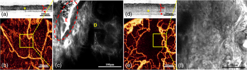 Combined two-photon microscopy and angiographic optical coherence tomography
