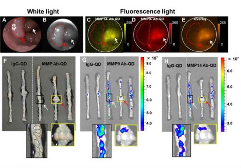 Intravital imaging of mouse colonic adenoma using MMP-based molecular probes with multi-channel fluorescence endoscopy