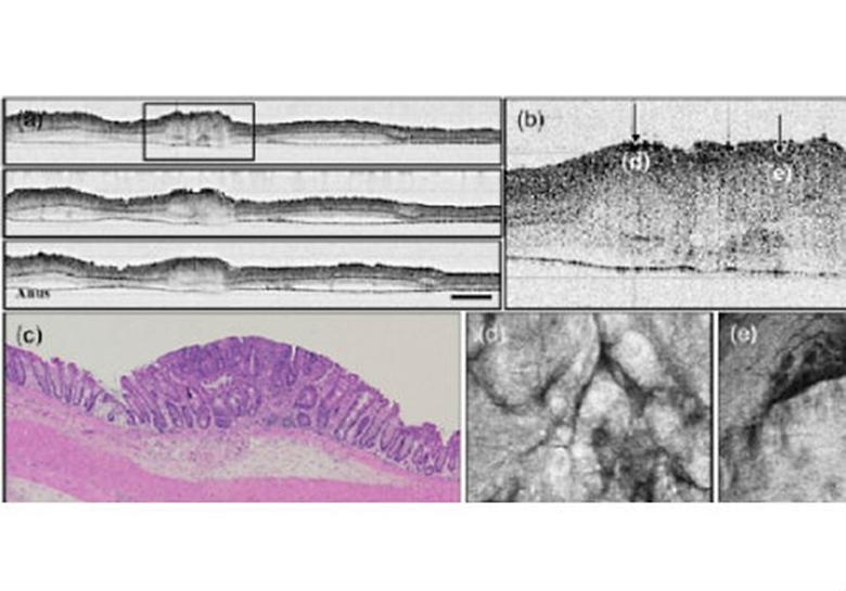 Gradient index lens based combined two-photon microscopy and optical coherence tomography