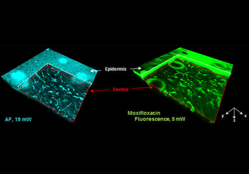 Moxifloxacin: Clinically compatible contrast agent for multiphoton imaging