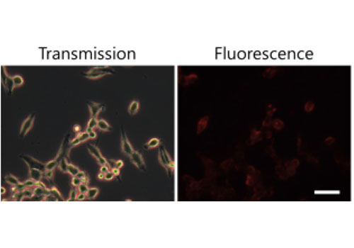 Clinically compatible flexible wide-field multi-color fluorescence endoscopy with a porcine colon model