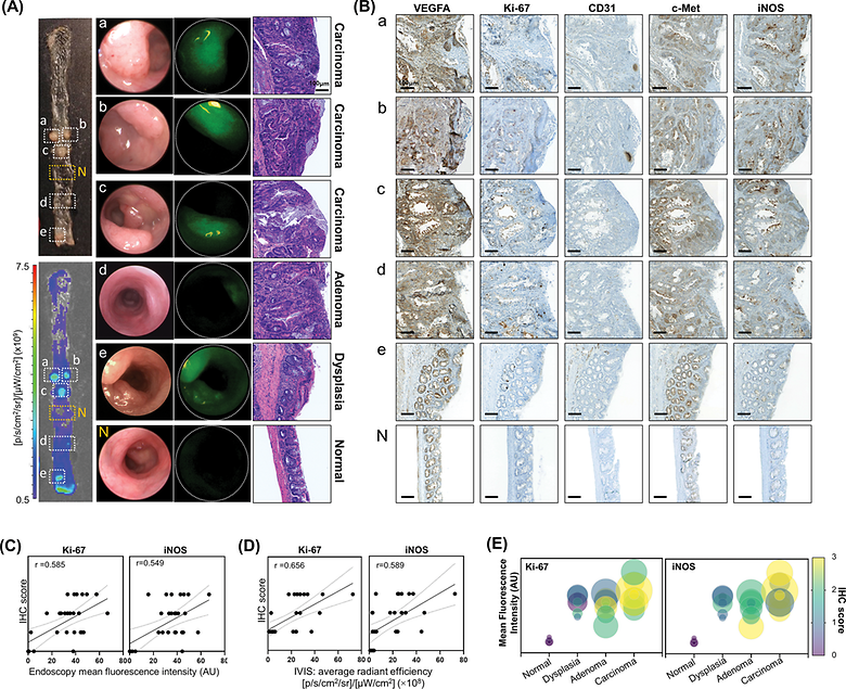 Investigation of artificial intelligence integrated fluorescence endoscopy image analysis with indocyanine green for interpretation of precancerous lesions in colon cancer